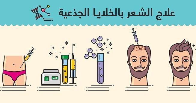 الخلايا الجذعية