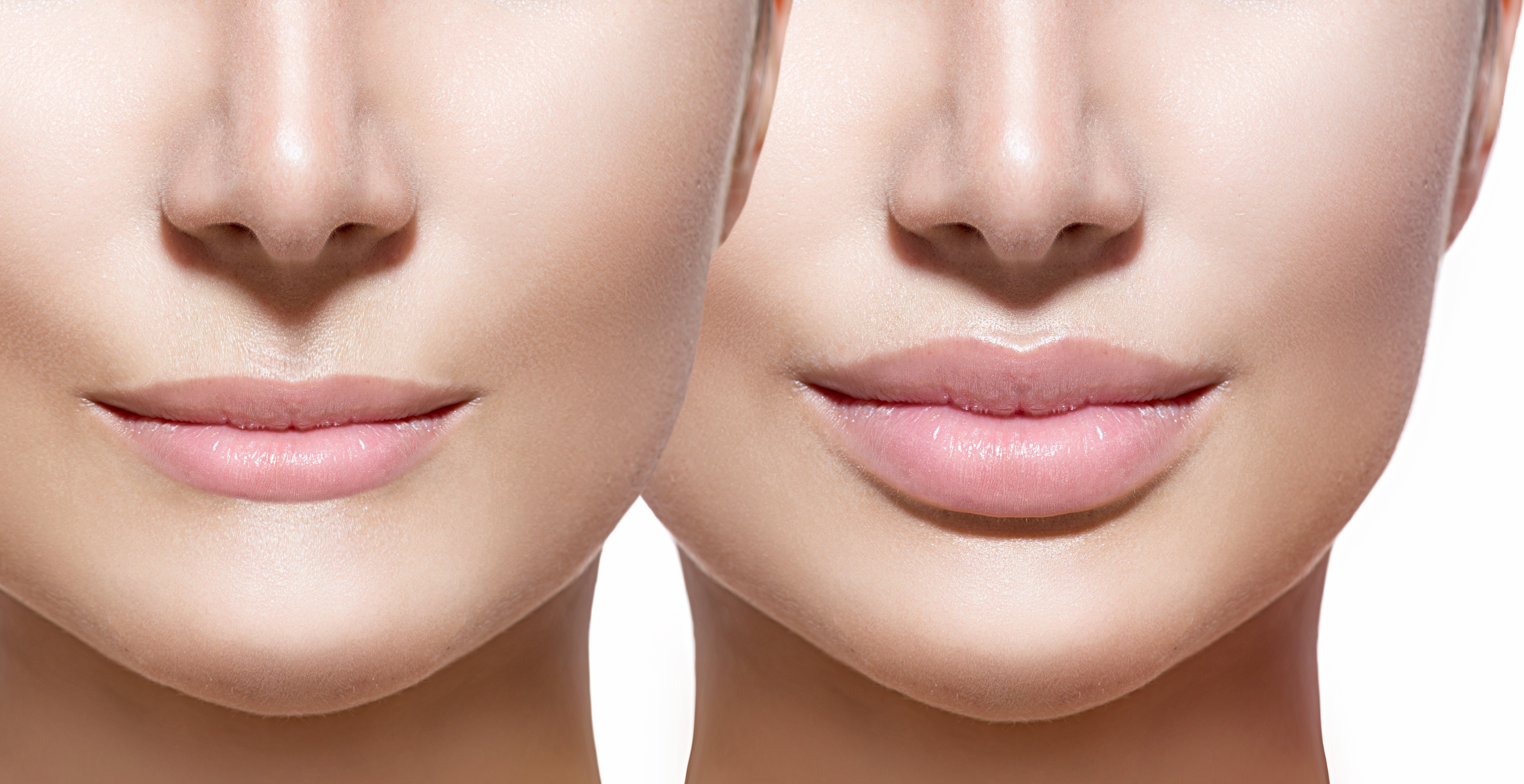 أخطاء تفاديها في عمليات التجميل