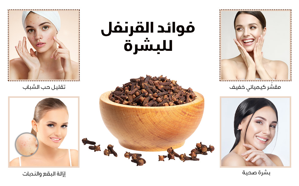 القرنفل 