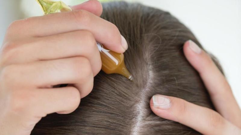 خلطات لعلاج قشرة الشعر