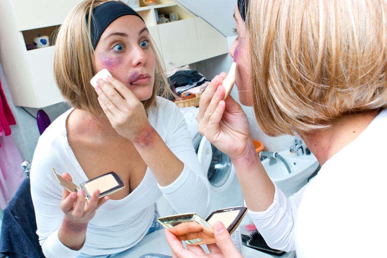 إخفاء الكدمات بالمكياج