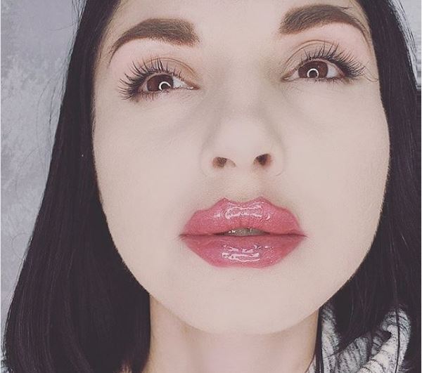 عملية تجميل شفاه الشيطان