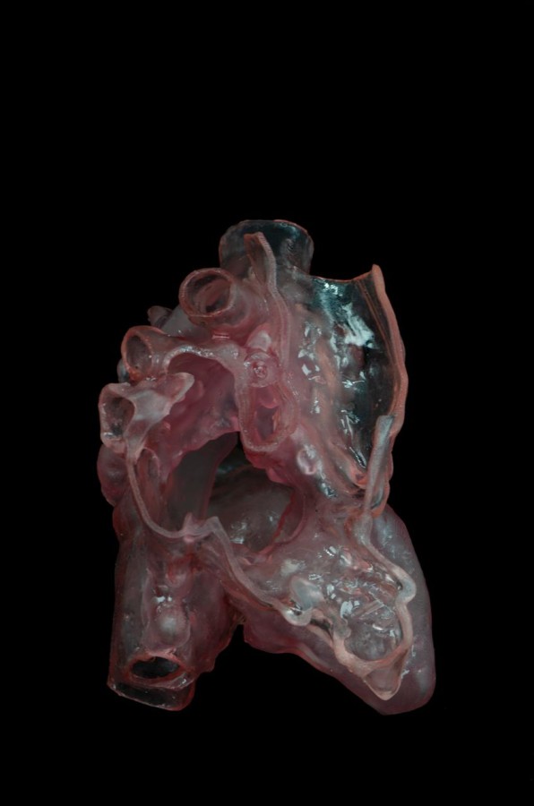 تعتمد تقنية الطباعة ثلاثية الأبعاد على مسار علمي دقيق يبدأ بتقييم الحالة بواسطة صور القلب الطبية الناتجة عن الأشعة فوق الصوتية