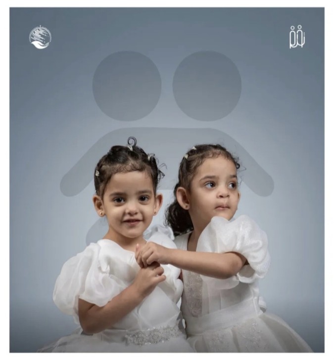 من جسد واحد إلى حياتين (الصورة من حساب مركز الملك سلمان للإغاثة في إكس)