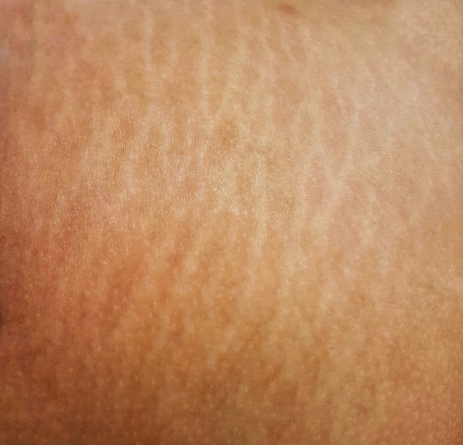 السترتش ماركس