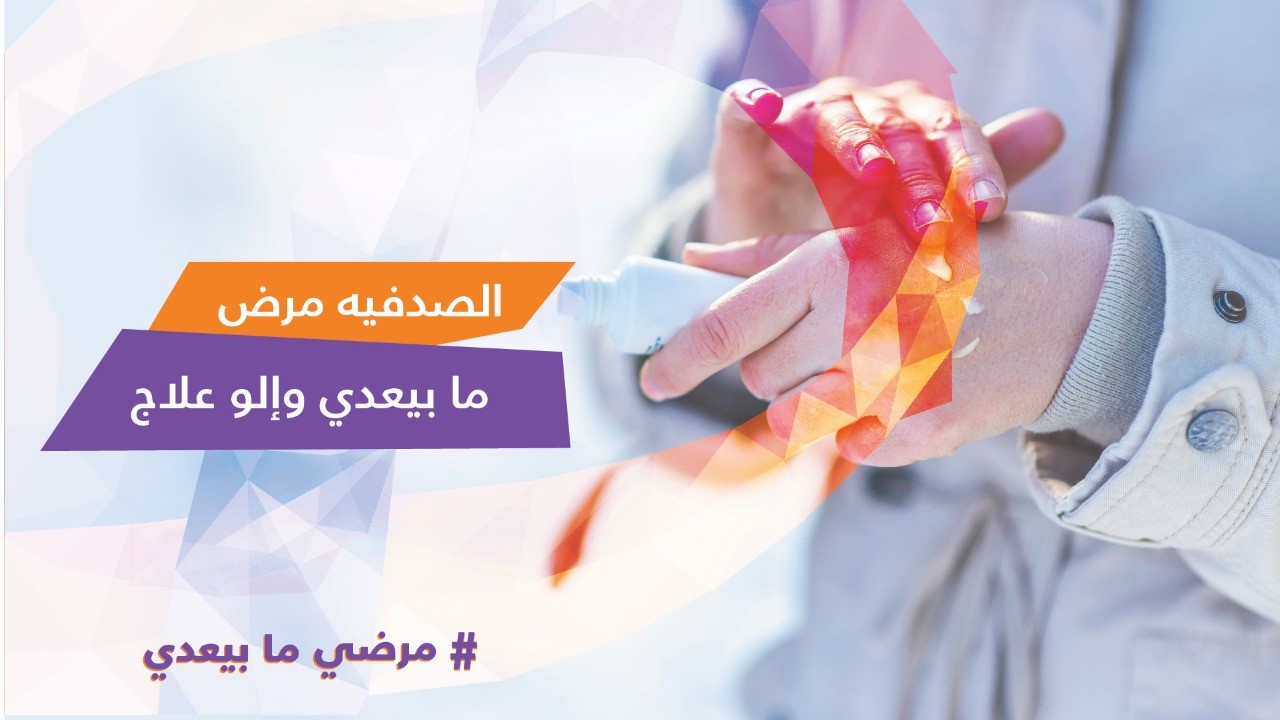 مرض الصدفية غير معدٍ