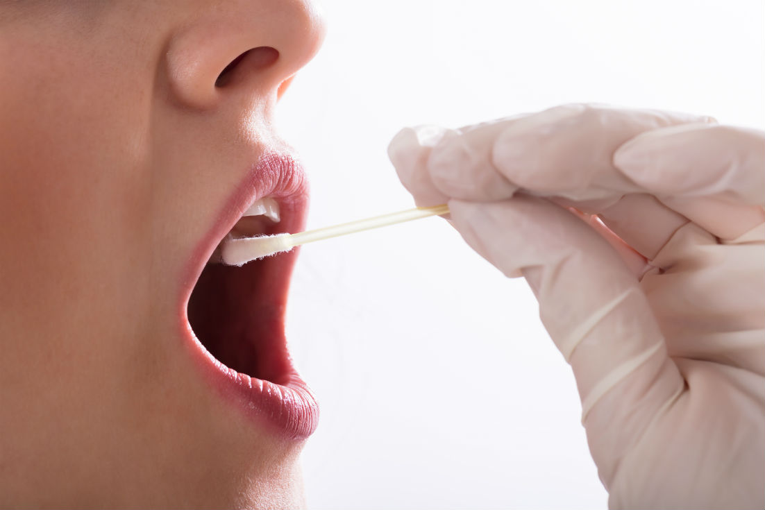 تصيب الغدة النكافية أمراض فيروسية
