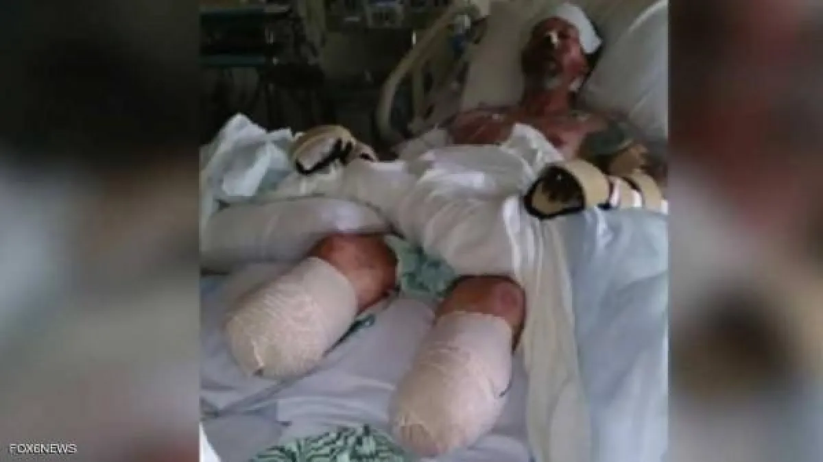 لعقه كلبه فبتروا أطرافه الأربعة.jpg