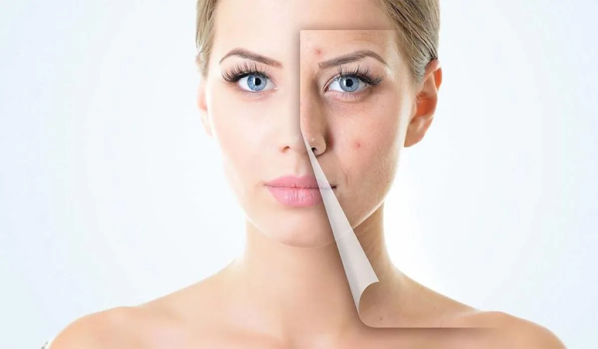 خلطة الزبادي والعسل