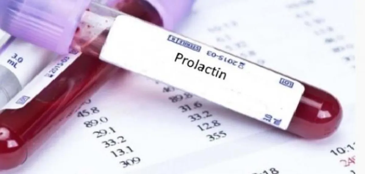يعرف بهرمون البرولاكتين