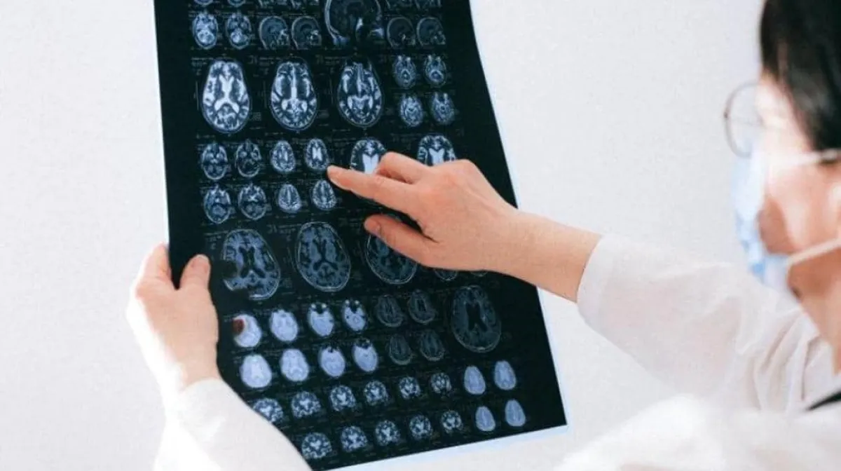 علماء يشرحون كيفية انتقال كورونا من الأنف إلى الرئتين والدماغ 