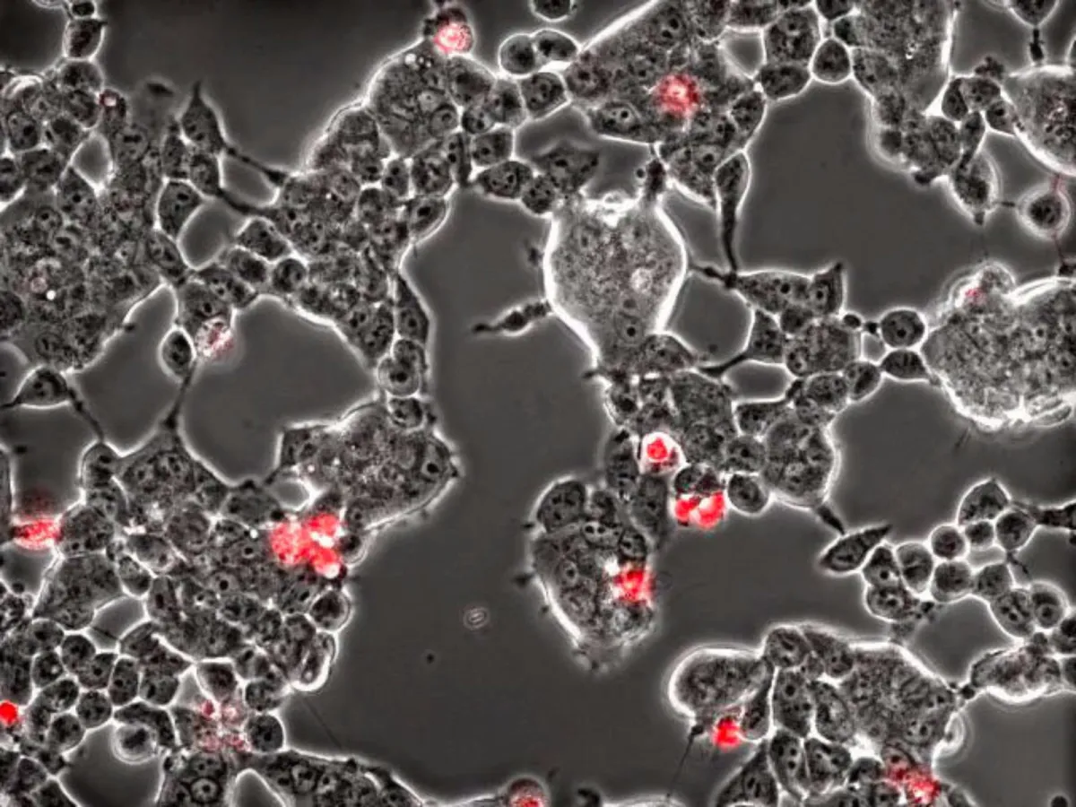 كيف يحول كورونا خلايا أدمغة الخفافيش إلى مصنع للفيروسات؟