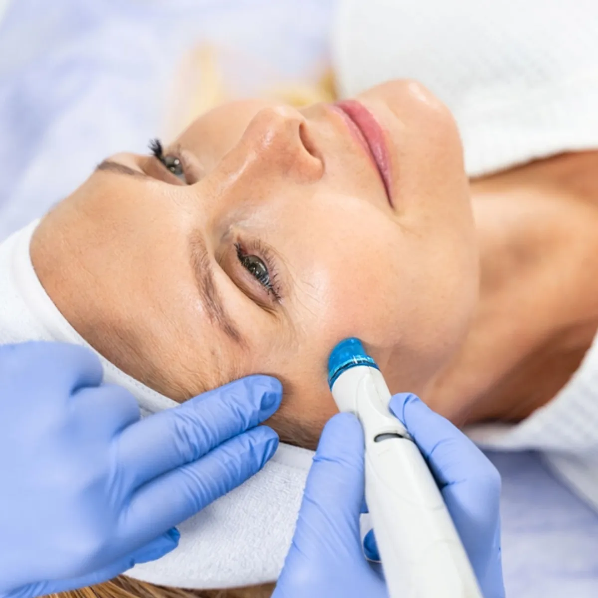 تقنية المايكرو ديرما بريجن