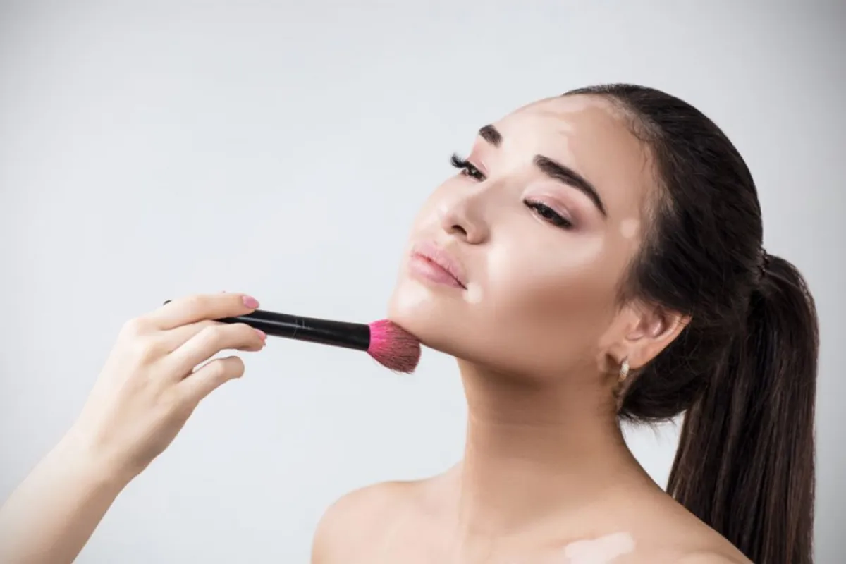 مكياج للبهاق