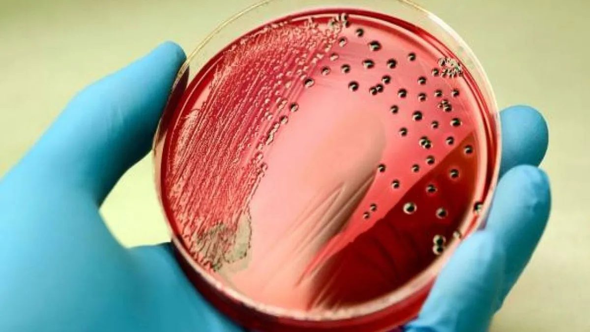 تؤثر حالة انتنان الدم على الأشخاص في أي عمر