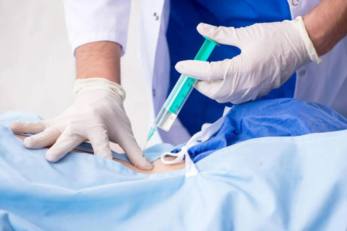 صورة لإبرة الظهر