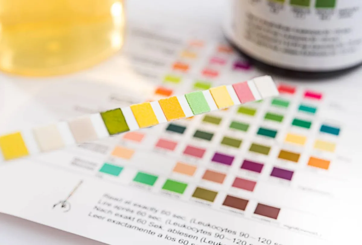 صورة لتغيير لون البول 