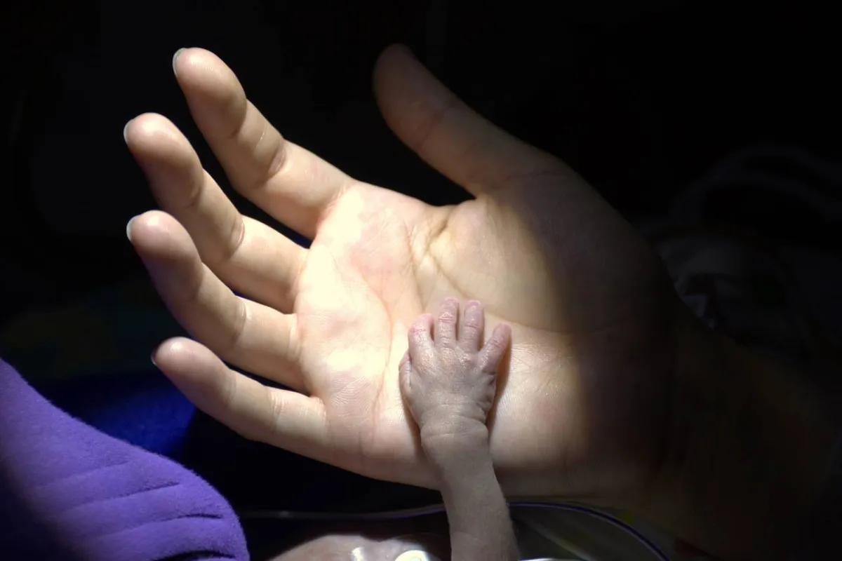 صورة ليد طفل خديج