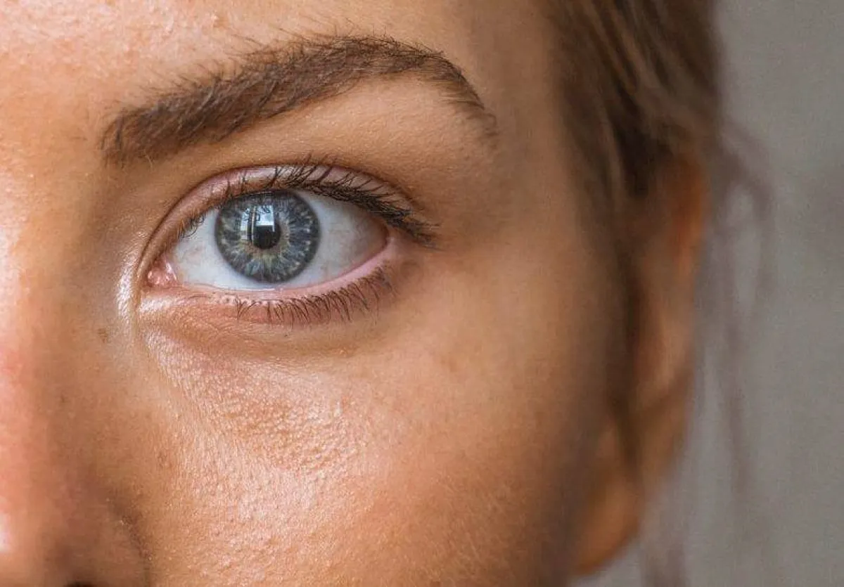 زيادة الحساسية للضوء