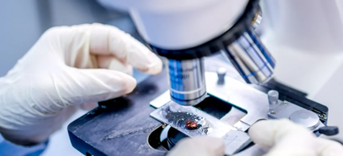 بحث علمي طبي لعلاج الزهايمر