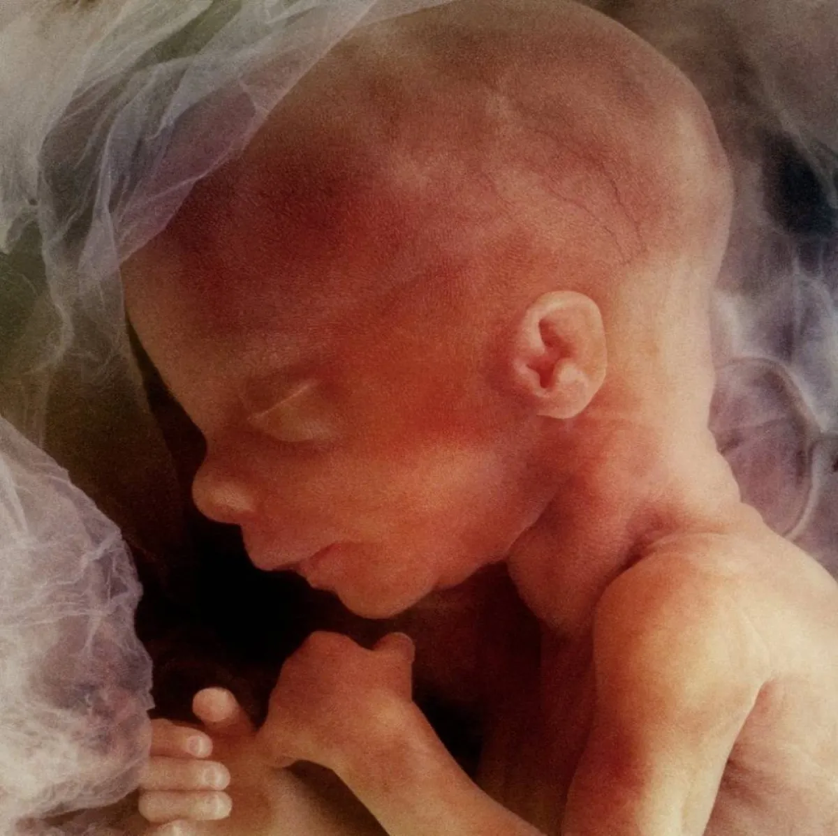 صورة جنين في بطن الأم