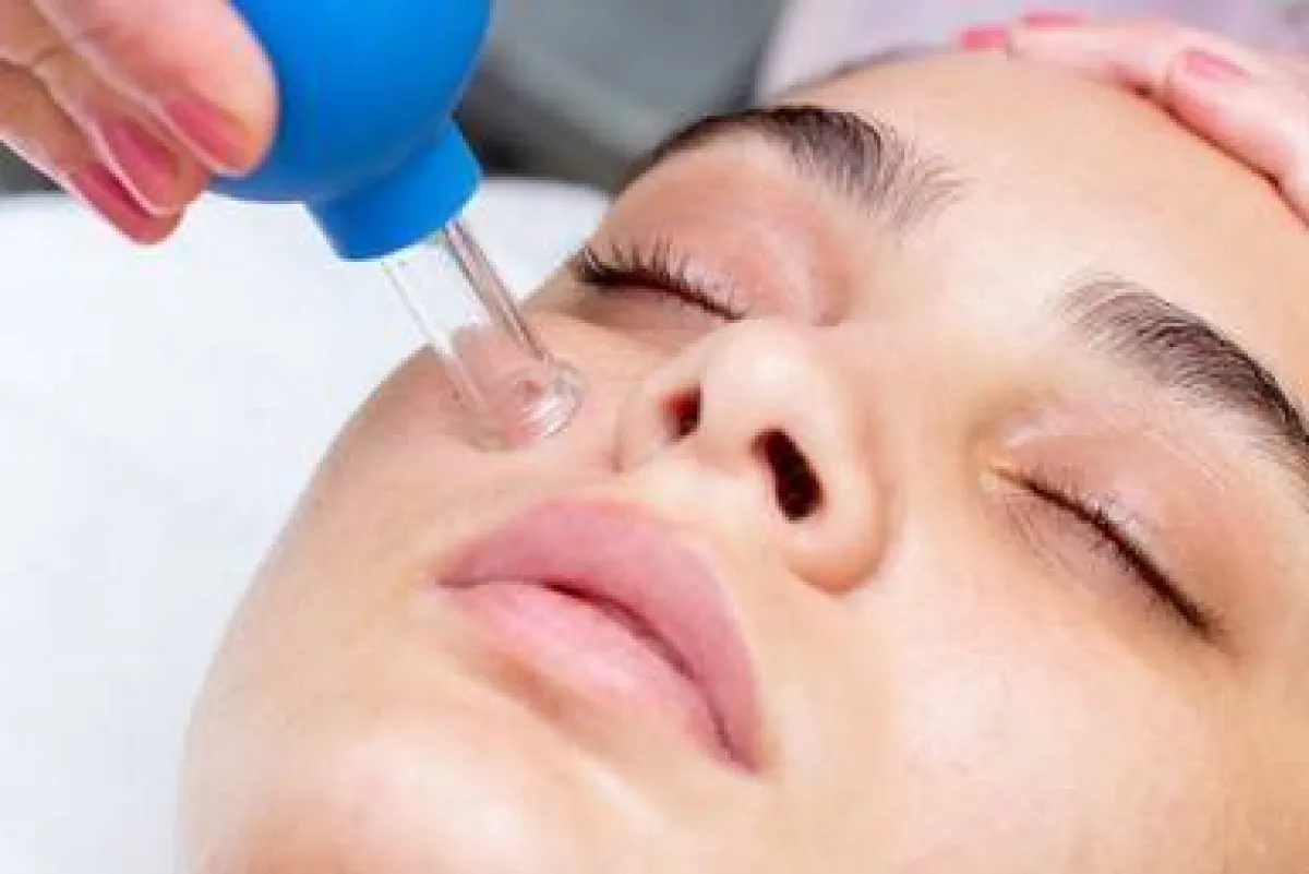  الحجامة للوجه: كيف تعمل وما هي فوائدها؟ 