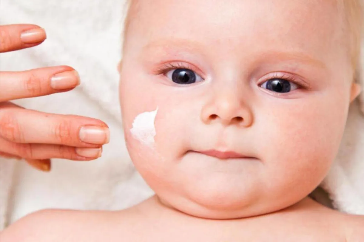 صورة لعلاج الطفل من الأكزيما