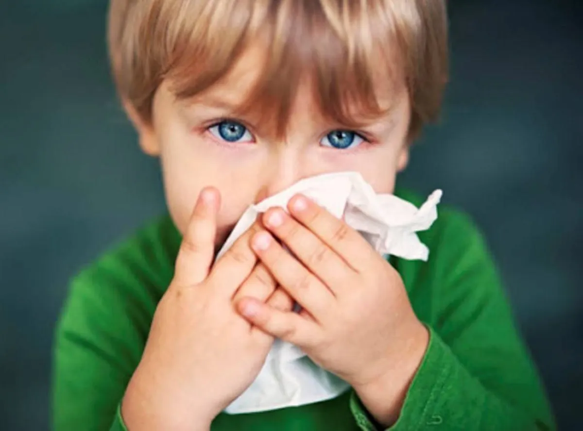 صورة لطفل يعاني من سيلان الأنف