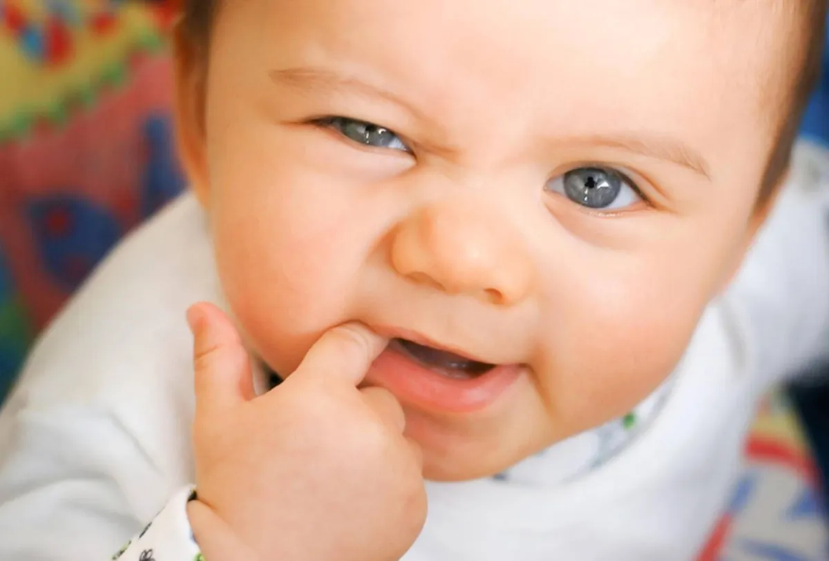 صورة لطفل تظهر عليه علامات التسنين 