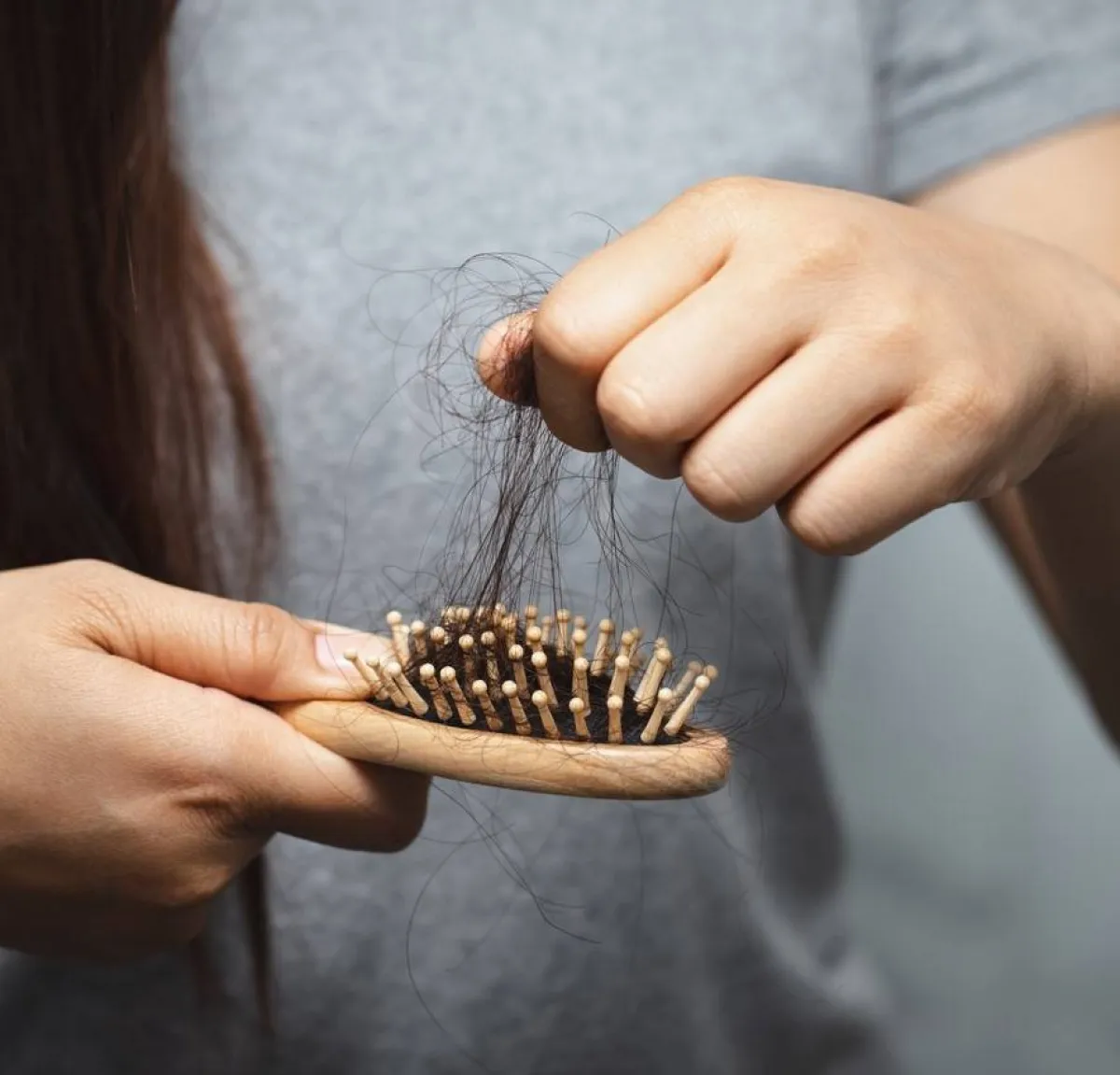 صورة تعبر عن تساقط الشعر