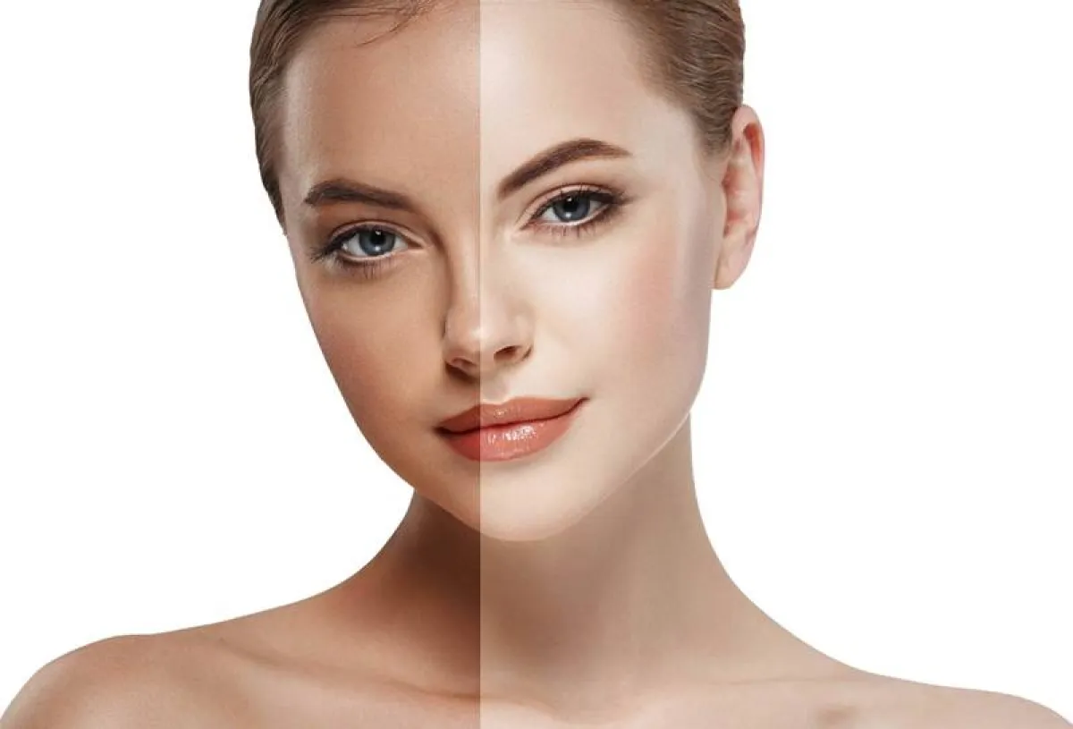 تبييض البشرة