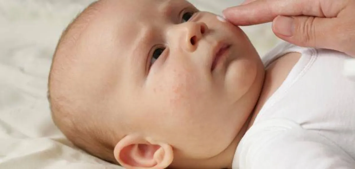 صورة لأم تحاول ترطيب بشرة طفلها بالكريمات