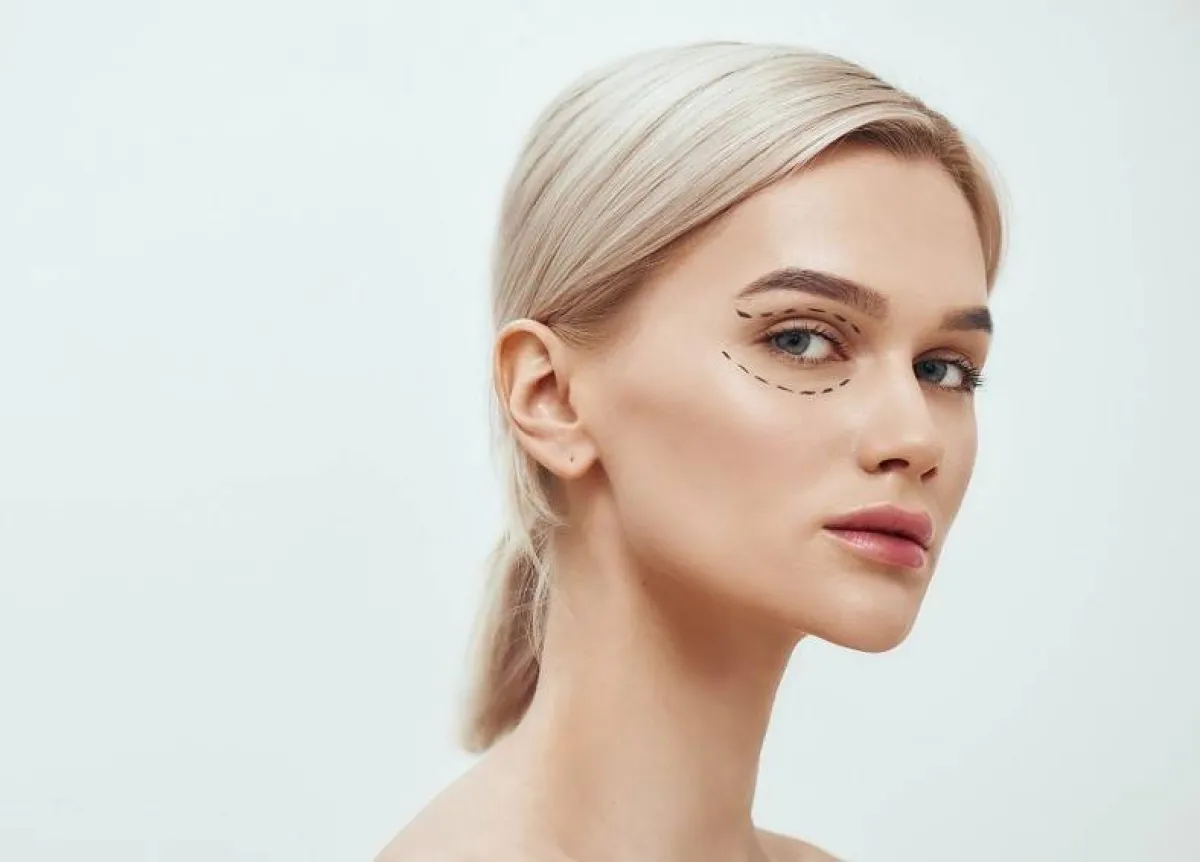 ما هي جراحة تجميل الجفن Blepharoplasty  ؟