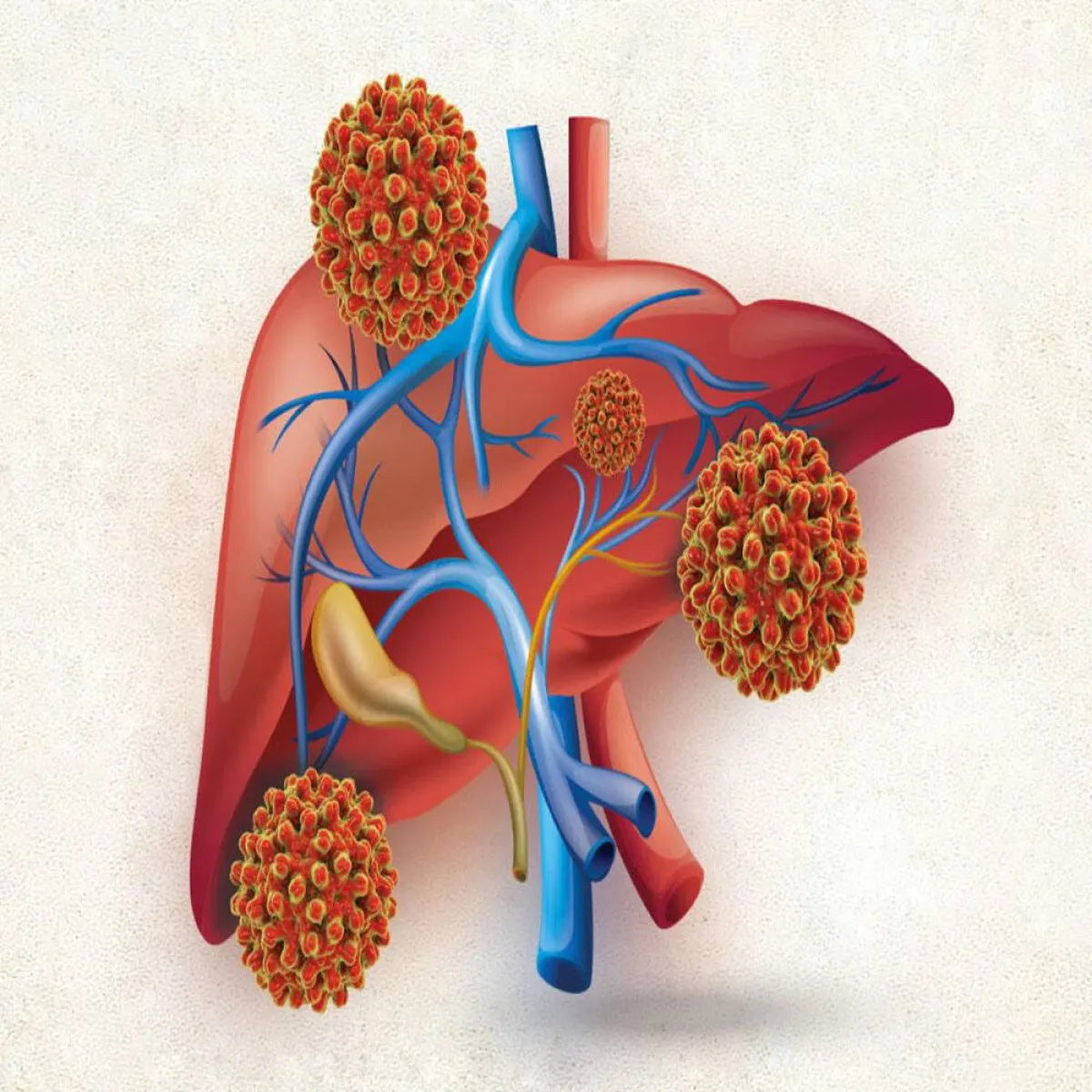 أعراض التهاب الكبد