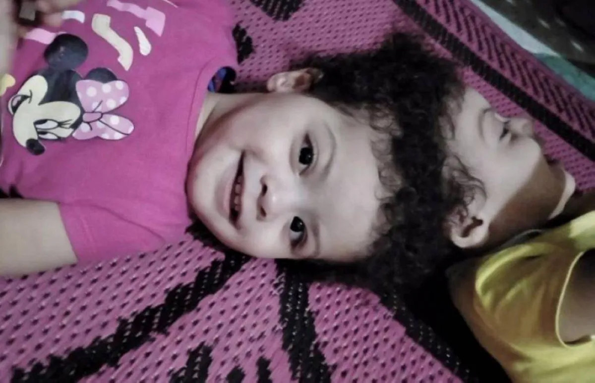 وصول التوأم السيامي المصري سارة وسلمى إلى الرياض