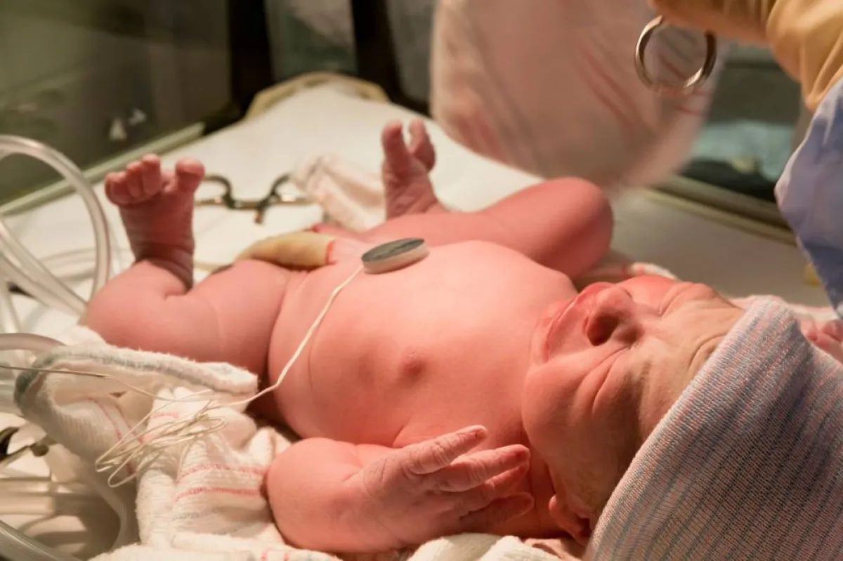 صورة لمولود في الحاضنة