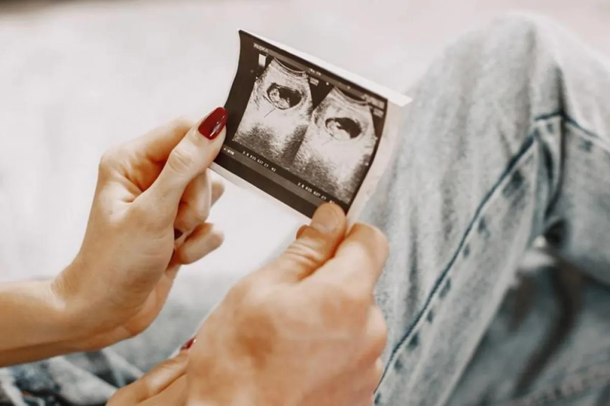 صورة لزوجين يراقبان أشعة الجنين