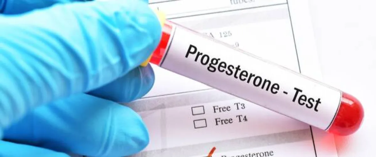 صورة توضح فحوصات هرمون البروجيسترون وهو هرمون الحمل