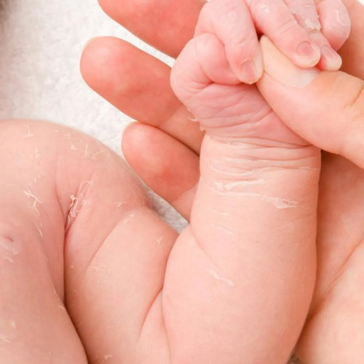 صورة تعبيرية لتقشف الجلد