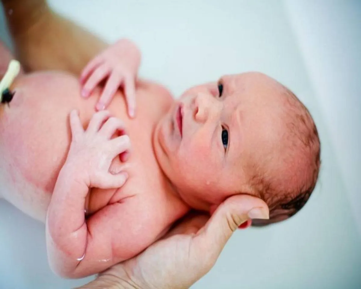 صورة لطفل رضيع يعاني من مشكلات صحية كثيرة