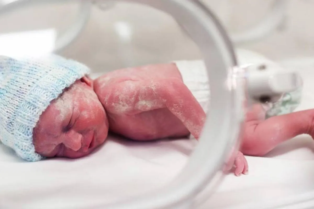 صورة لطفل مريض في الحضانة