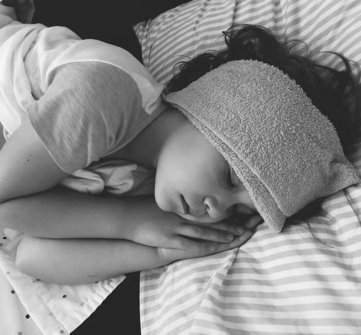 صورة لطفلة مصابة بالحمى