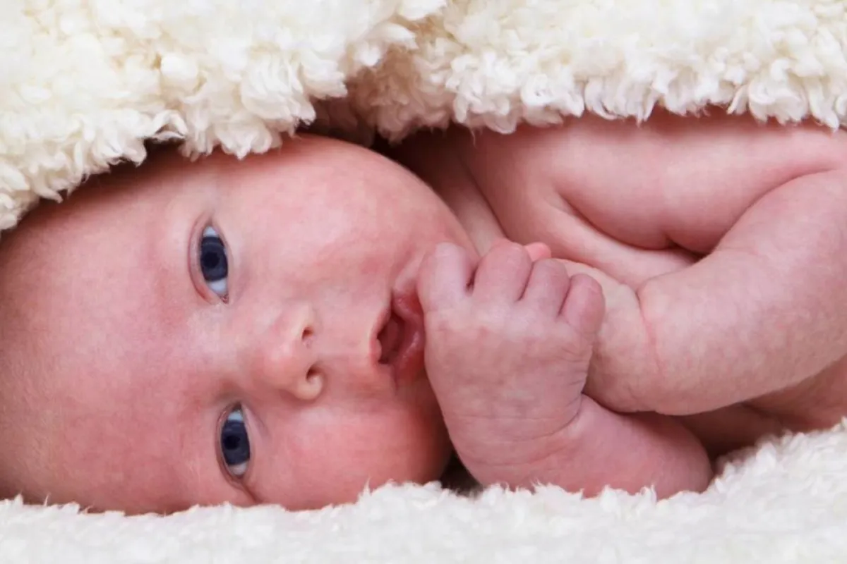 أسباب تقشر بشرة حديث الولادة