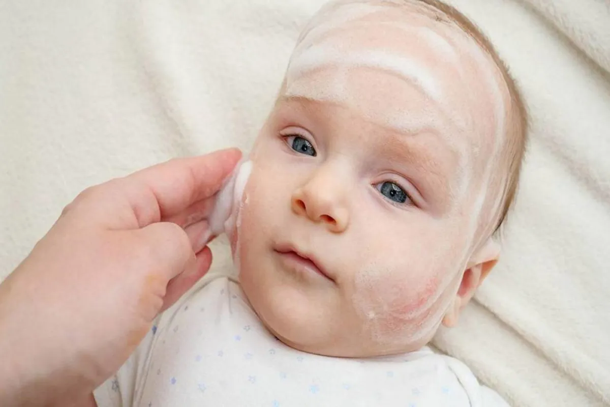 الطفح الحراري عند الأطفال: أنواعه وأعراضه وعلاجه والوقاية منه