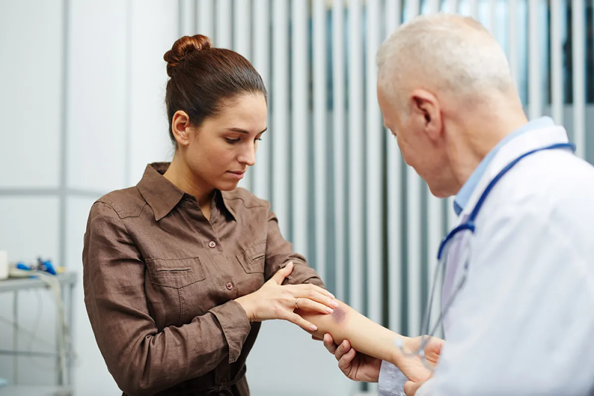 أسباب ظهور الكدمات المفاجئة في الجسم