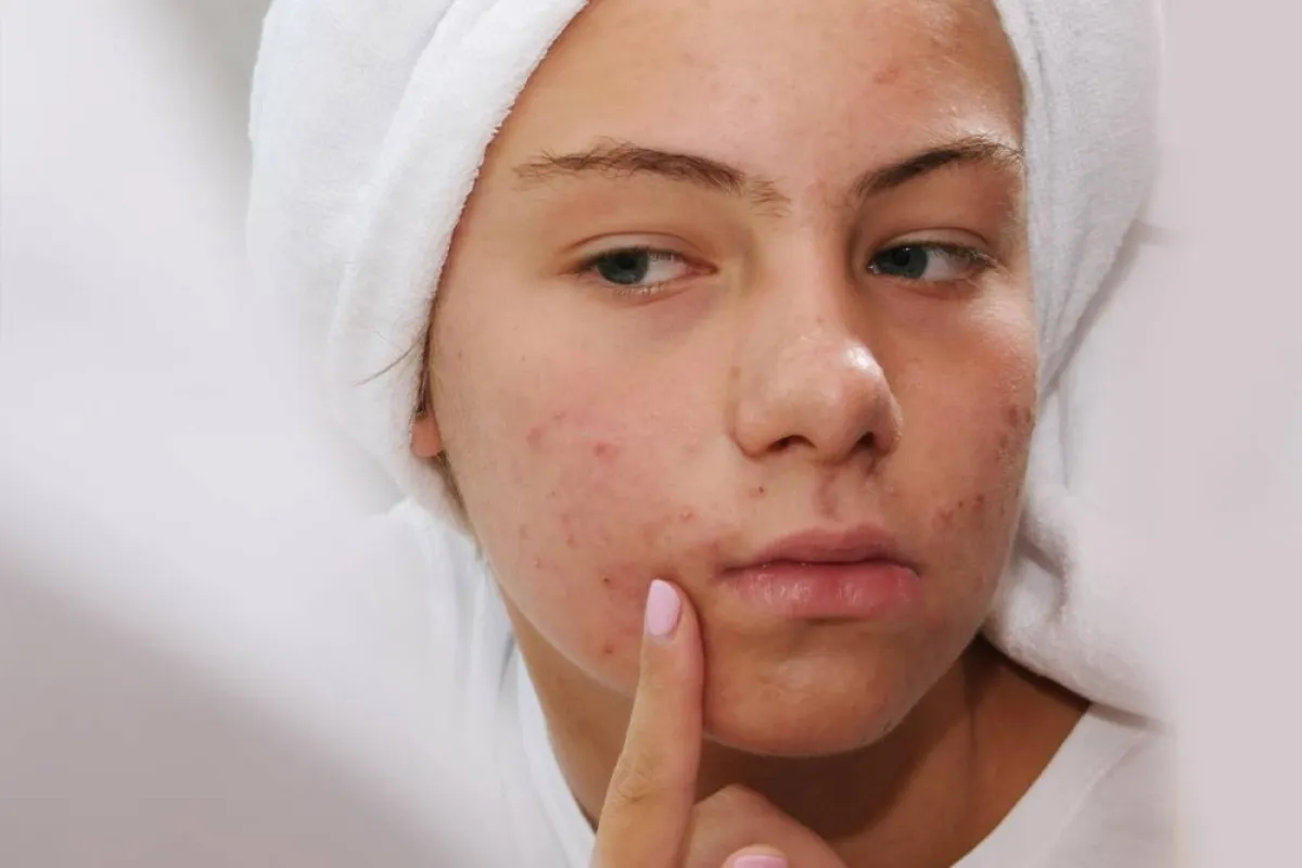 الطفح الجلدي عند الحامل: أنواعه وطرق علاجه