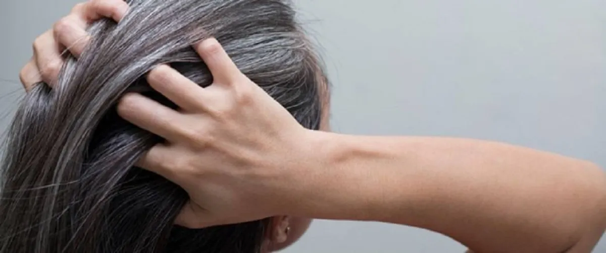 أسباب ظهور الشيب المبكر عديدة