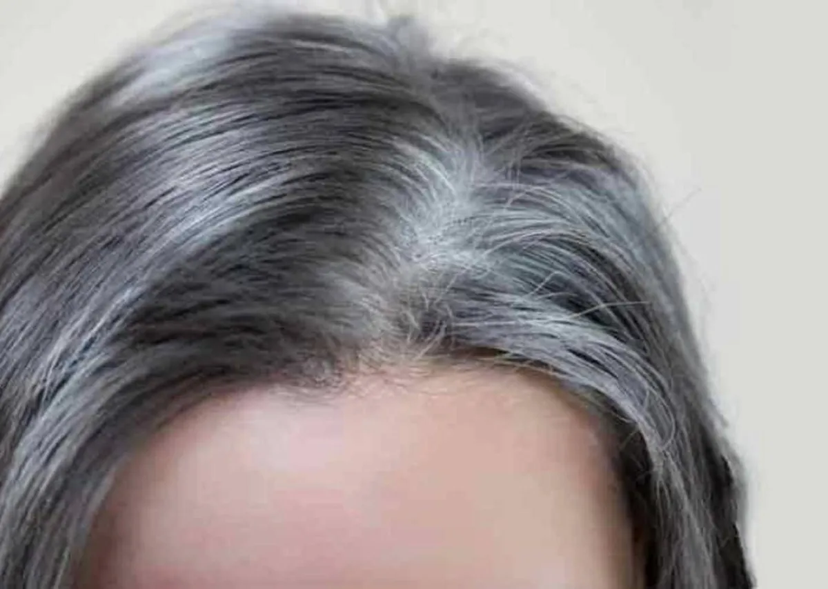 الشيب المبكر يمكن تجنبه