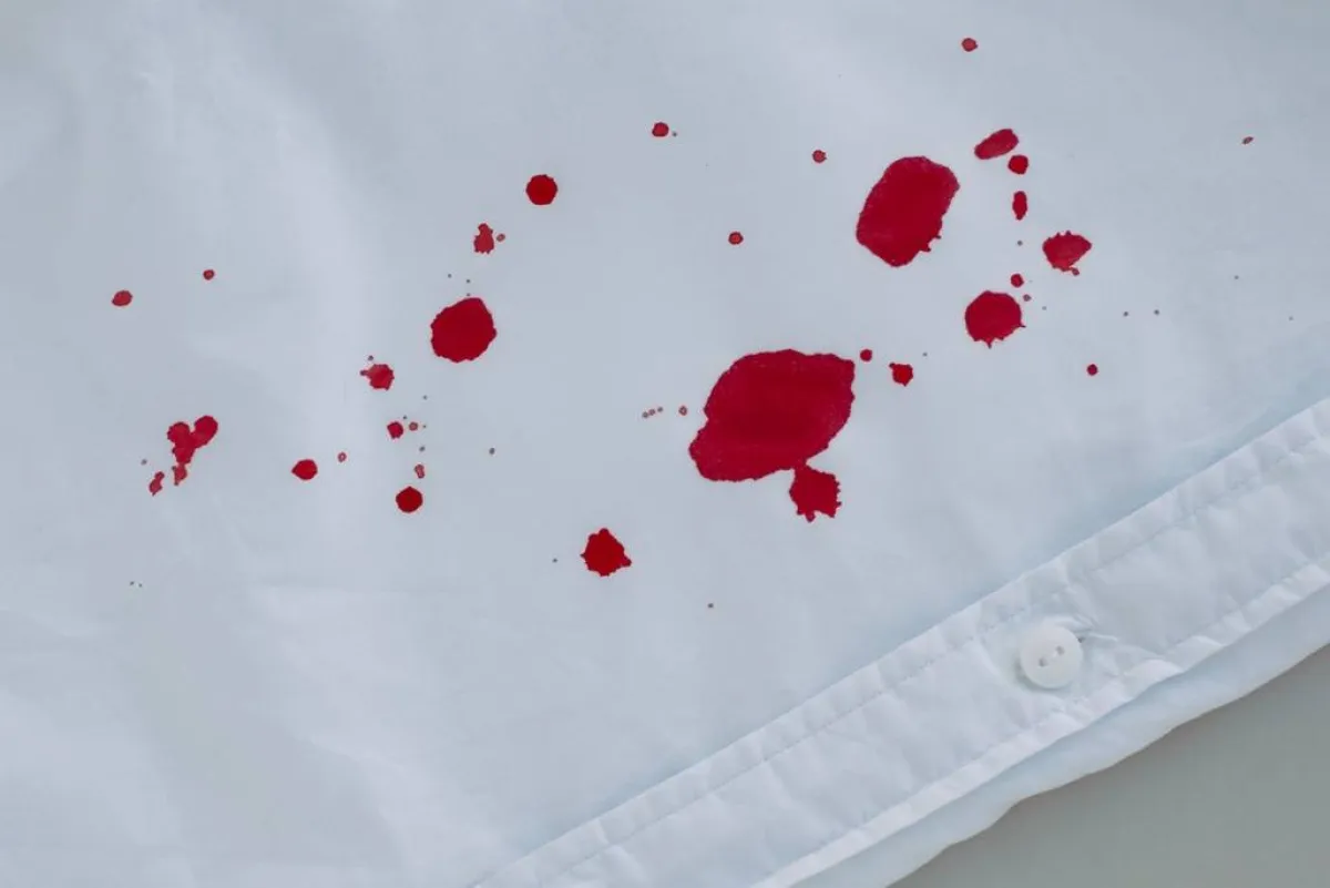 بقع الدم على الملابس