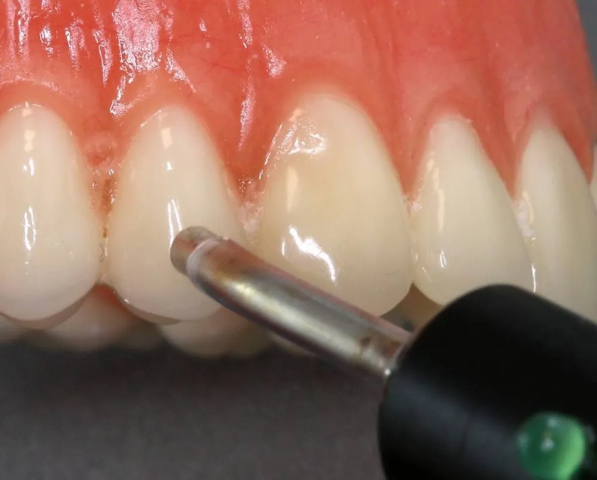 خلايا لب الأسنان